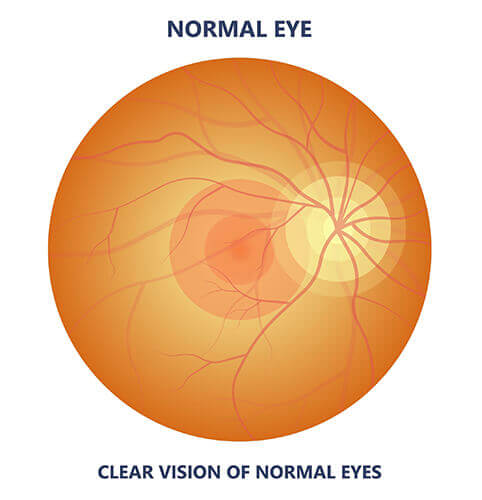 Normal eye and macula